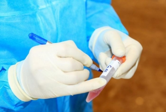 1 So Ca Mac Covid 19 Ca Nuoc Gia Tang Nhieu F0 Phat Hien Qua Dau Hieu Ho Sot