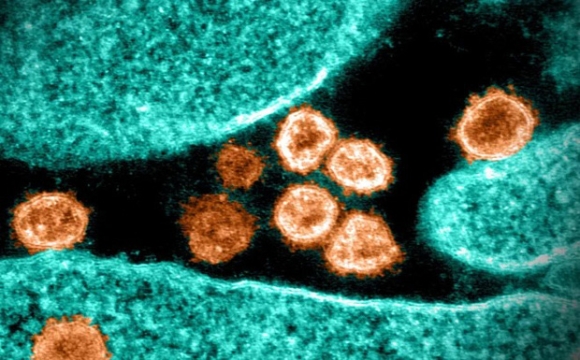 2 Bua Tiec Giang Sinh Tro Thanh O Dich Bien The Omicron Lon Nhat The Gioi Ben Ngoai Nam Phi