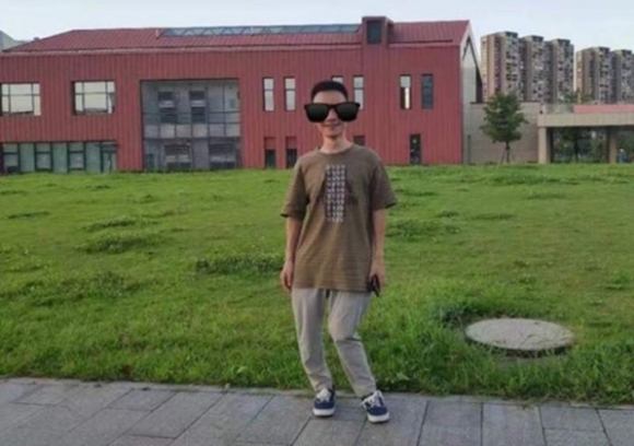 1 Chang Trai Co Xuong Song Cong Nhu Soi Mi Chi Vi Thieu Vitamin Nay