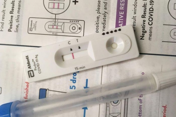 1 Singapore Tuyen Bo Xet Nghiem Nhanh Khang Nguyen Phat Hien Duoc Omicron