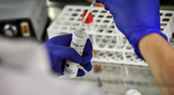 1 Triet Pha Duong Day Ban Virus Sars Cov 2 Cho Nguoi Muon Tu Lay Nhiem