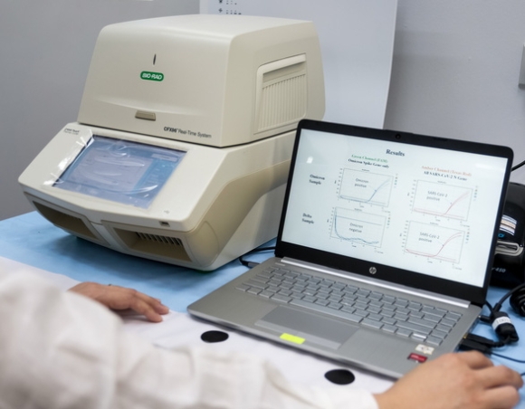 2 Covid 19 The Gioi 12 12 An Do Singapore Lam Duoc Kit Phat Hien Nhanh Omicron