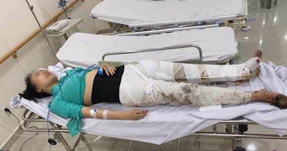 3 Tiep Vien Hang Khong Bi Mercedes Dam Chan Dong 2 Nam Truoc Tiet Lo Chuyen Duoc Bao Mong