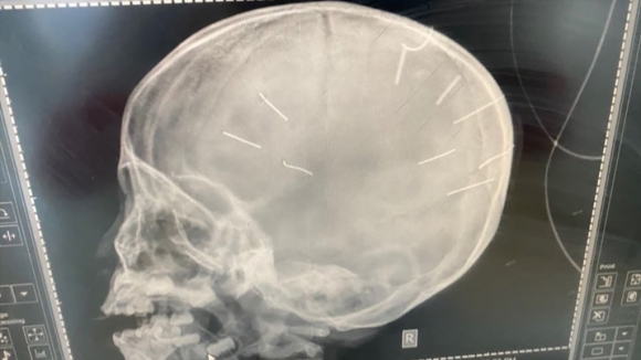 1 Vu Be Gai Co 9 Vat Cung Gam Trong So Ong Noi Cau Cuu Tong Dai 111