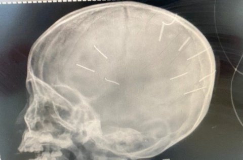 1 Suc Khoe Cua Be Gai Bi Dinh Gam Vao Dau Kho Noi Truoc