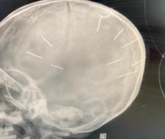 3 Khoi To Bat Giam Nghi Pham Gam Nhieu Dinh Vao Dau Be Gai 3 Tuoi O Ha Noi