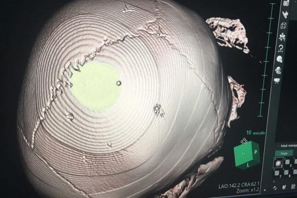 4 Tinh Tiet Tang Nang Doi Voi Ke Dong Dinh Vao Dau Be Gai 3 Tuoi