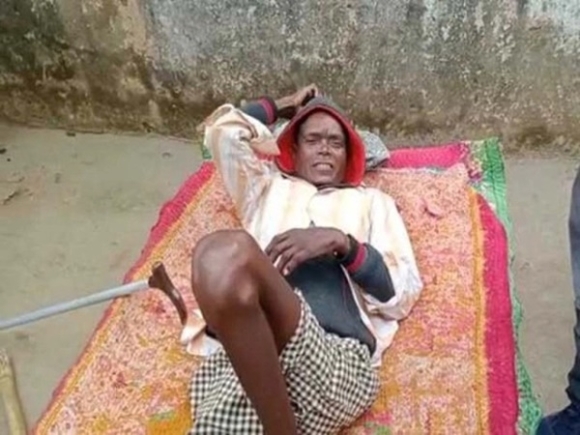 2 Nguoi Dan Ong Bi Liet 5 Nam Bong Dung Dung Day Di Lai Chi Sau Mui Tiem Covid 19 Bac Si Cung Soc Nhung Phai Xac Nhan Mot Dieu