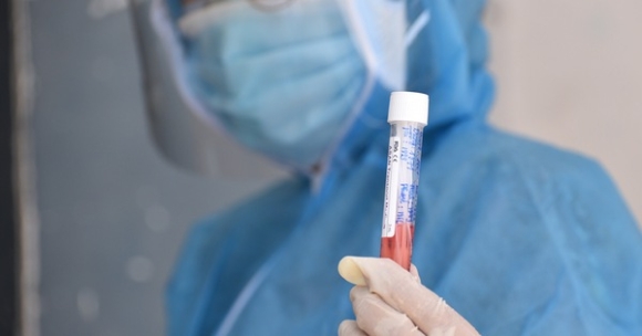 1 Binh Duong Ghi Nhan Ca Nhiem Bien The Omicron