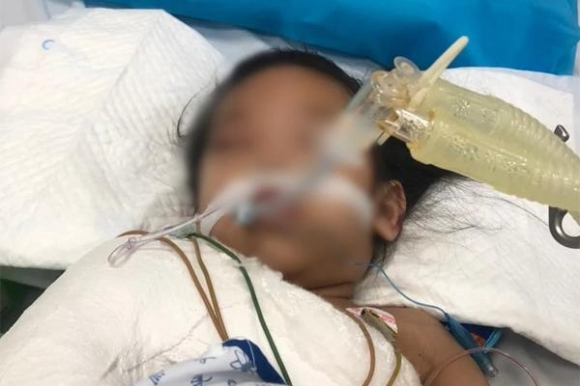 1 Be 3 Tuoi O Ha Noi Bi Ghim Dinh Vao Dau Van Chua The Phau Thuat