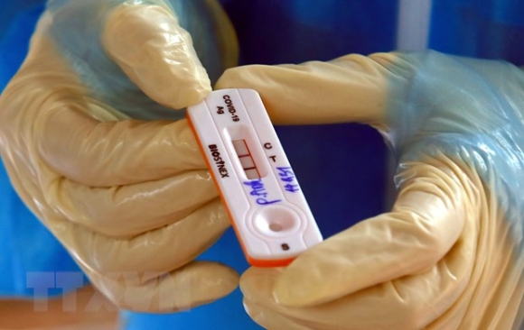 1 Truong Hop Nhiem Bien Chung Omicron Cong Dong O Ha Noi Da Khoi Benh