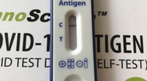 1 An Uong Truoc Khi Lay Mau Co The Lam Sai Lech Ket Qua Xet Nghiem Rat