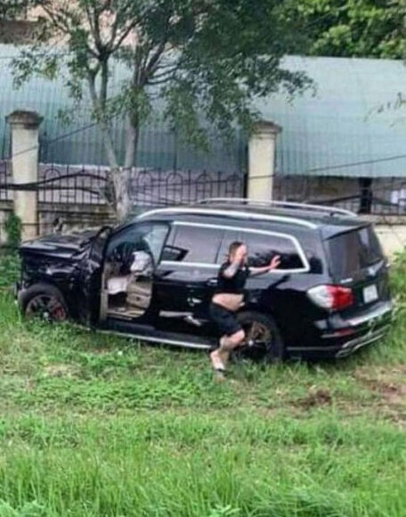 1 Vu Mercedes Dien Gay Tai Nan Khien Nguoi Phu Nu Dut Lia Chan Tay Tai Xe Co The Doi Mat 10 Nam Tu
