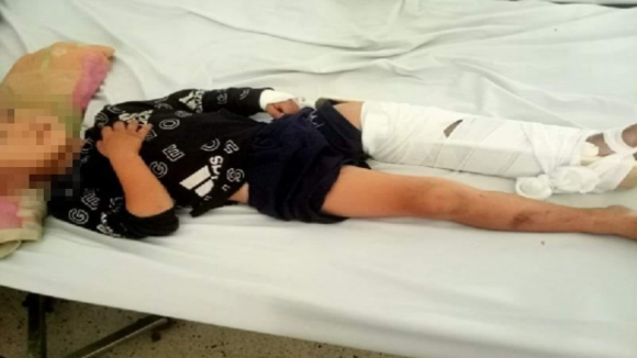 2 Tphcm Dau Long Be Trai 4 Tuoi Theo Me Ban Ve So Bi Xe Tong Gay Chan