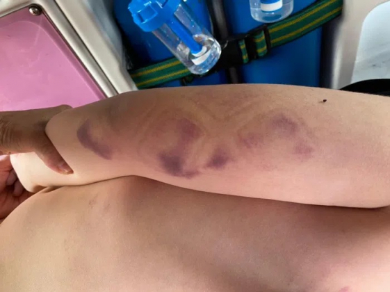 1 Be Trai 11 Tuoi Nguoi Nhat Tu Vong Tai Khu Nghi Duong O Mui Ne