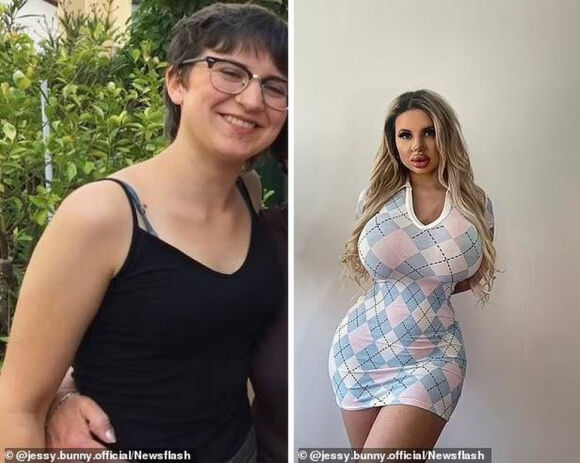 Cô gái bị gia đình từ mặt sau khi chi 1,6 tỷ đồng phẫu thuật thẩm mỹ