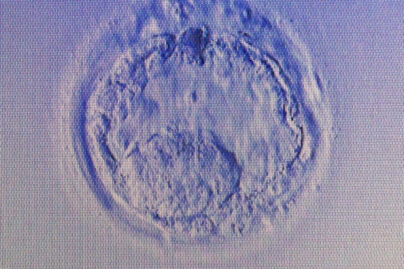 2 Lan Dau Tien Tai Viet Nam Vo Mang Thai Voi Chong Khong Co Tinh Trung