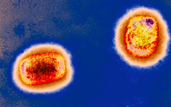 1 Dau Mua Khi Lan Ra Nhieu Nuoc Chau Au