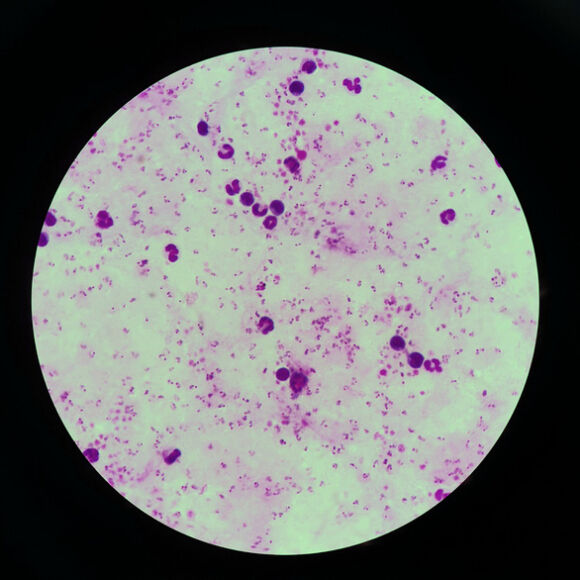 2 Tphcm Phat Hien 2 Nguoi Bi Sot Ret Ac Tinh Nhap Canh Tu Chau Phi