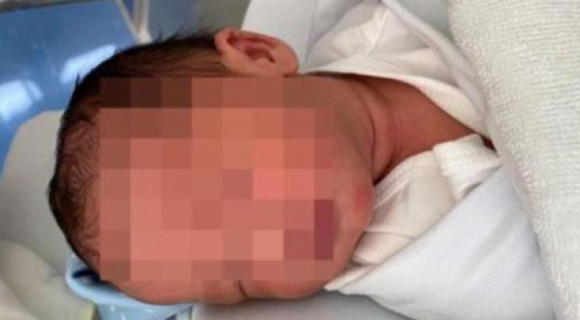 2 Em Be Dau Tien Tai Viet Nam Ra Doi Tu Me Bi Ung Thu Tu Cung