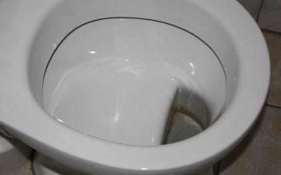 Người Đức thiết kế bồn cầu một mình một kiểu? Ai mới nhìn cũng phải trợn mắt, nhưng lợi ích phía sau thì không thể phủ nhận