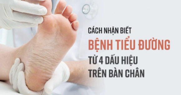 Bàn chân xuất hiện 4 dấu hiệu này chứng tỏ đường huyết tăng cao, ai không có thật đáng chúc mừng