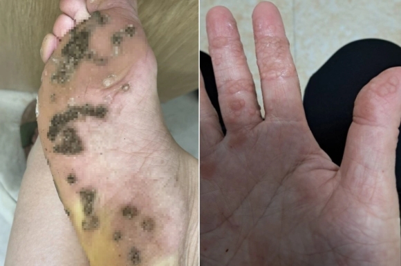 1 Ha Noi Ca Nha Noi Chi Chit Hat Com O Chan Vi Di Chung Dep