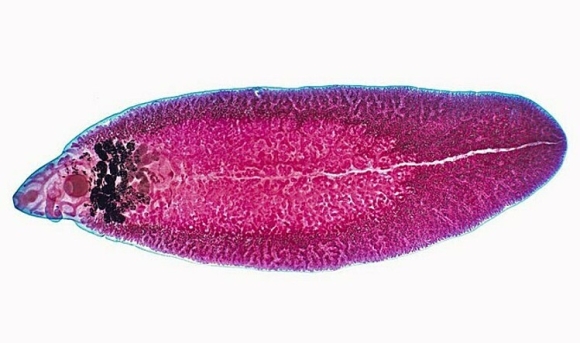 Sán lá làm tổ trong gan do ăn rau sống