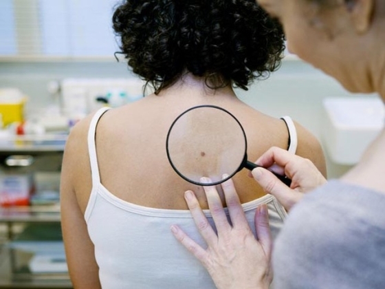 1 Nhung Dau Hieu Canh Bao Ung Thu Som Bac Si Huong Dan Cach Tu Kiem Tra Tai Nha