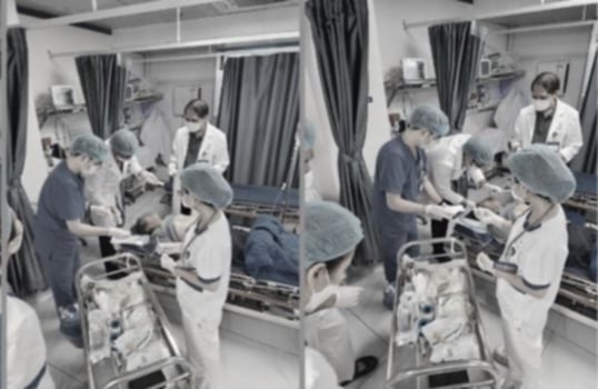 2 80 Ca Dot Quy Xuat Huyet Nao Co Lien Quan Toi 1 Thu Nhung Nhieu Nguoi Viet Van Chu Quan