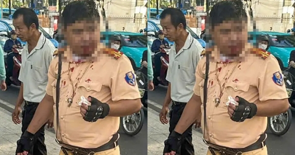 1 Thanh Nien Nguoi Nga Tan Cong Csgt O Nha Trang