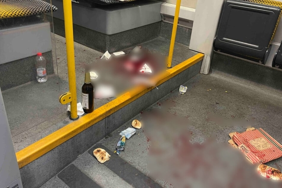 1 Cong Dan My Bi Dam Tren Xe Dien O Dresden Sau Khi Can Thiep Vu Quay Roi Phu Nu