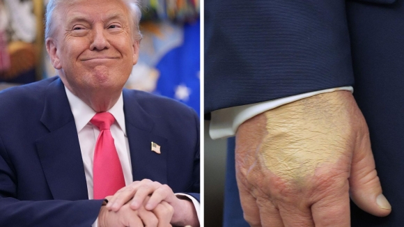 1 Ong Trump Bi An Tuyen Bo Gay Xon Xao Lieu Co Tu Chuc