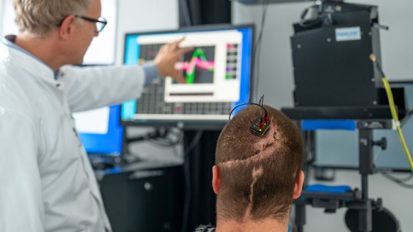 Lần đầu tiên tại châu Âu: Bệnh viện Đại học Kỹ thuật Munich đã cấy ghép giao diện não-máy tính giúp bệnh nhân liệt điều khiển robot bằng suy nghĩ