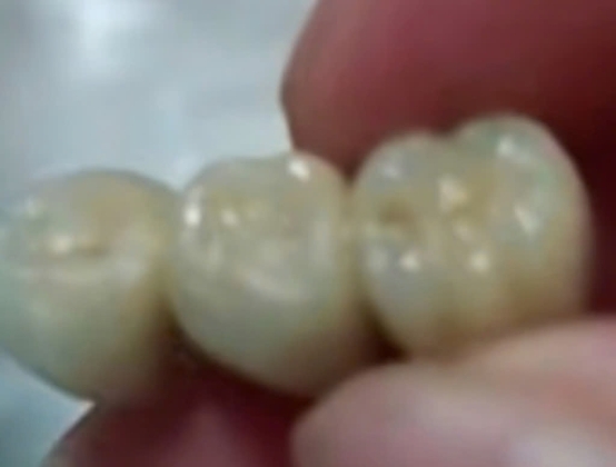 1 Khach Tq Hoang Hot Khi Phat Hien Rang Gia Trong Xuc Xich Dim Sum